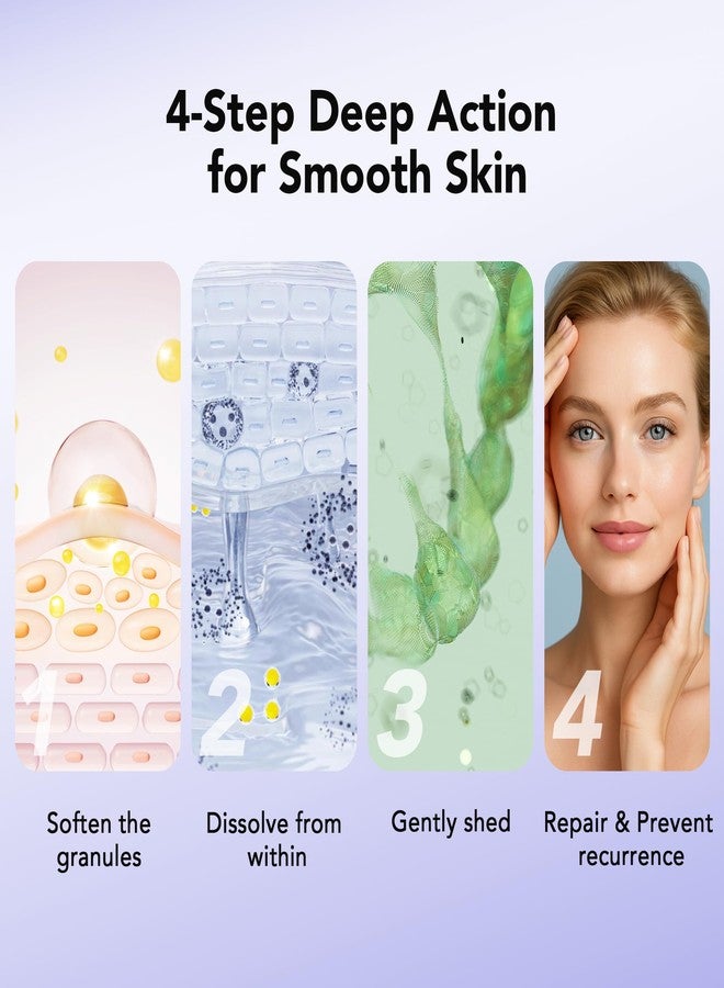 ديرمفري مزيل الدخينات 30 مل، علاج موضعي للدخينات مع حمض الساليسيليك، سيروم لتنقية البشرة من حب الشباب الدخيني - Image 3